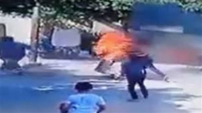شاب يشعل النيران في نفسه بسبب خلافات أسرية بالغربية