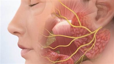 أعراض التهاب بالعصب السابع وطرق علاجه