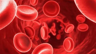 اعراض زيادة الحديد في الدم.. الدوخة وتساقط الشعر أبرزها