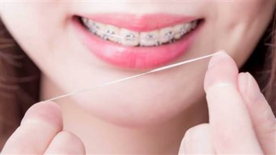 كيف تعالج اللثة الملتهبة؟ طبيب فم وأسنان يقدم حلولا منزلية سحرية