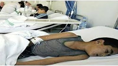 إصابة 11 تلميذا في سوهاج بالغدة النكافية