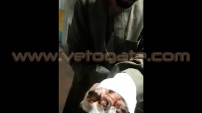 بالفيديو والصور.. للمرة الثانية ضبط متسول يدّعي قطع أطراف يده