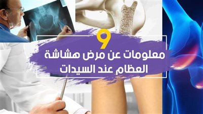 9 معلومات عن مرض هشاشة العظام عند السيدات | فيديوجراف