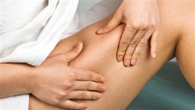 كل ماتريدين معرفته عن السلوليت وكيفية علاجه ووهم المشاهير