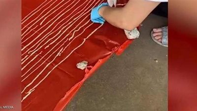 استخراج دودة شريطية طولها 18 مترا من جسد مسن في تايلاند