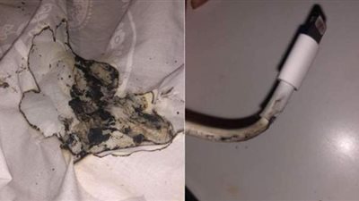 أبل تفتح تحقيقا في واقعة حرق وجه فتاة بسبب اشتعال شاحن آيفون فجأة