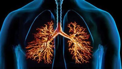 أعراض التهاب الشعب الهوائية