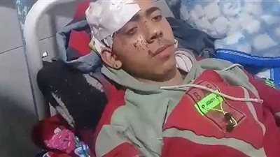 أحد مصابي حادث قطاري سوهاج: 