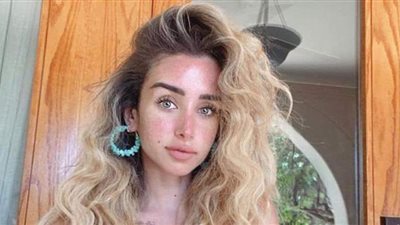 هنا الزاهد تكشف تطورات حالتها الصحية بعد إصابتها بـ