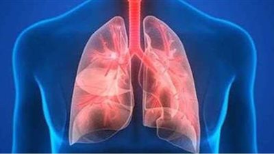 أعراض الالتهاب الرئوي وطرق الوقاية