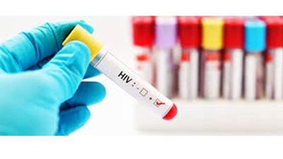 كل ما تريد معرفته عن مرض نقص المناعة المكتسب (الإيدز)