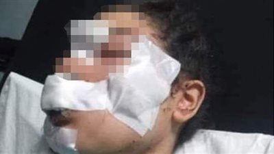 رفضت العودة للمنزل.. نجار يشوه وجه زوجته بـ «مياه النار» في الإسكندرية