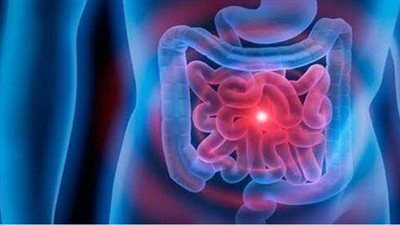 ما هو مرض تسرب الأمعاء والمشكلات الصحية الناجمة عنه