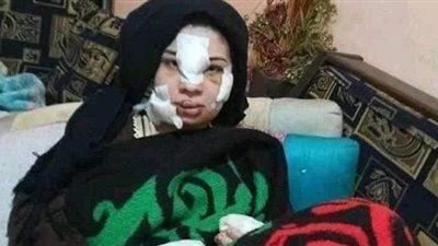 إسراء عماد بعد خروجها من المستشفى: أعيش في كابوس بسبب تشويه وجهي وسمعتي