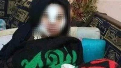 إسراء عماد المعتدى عليها من زوجها: شوه وجهي بالمطواة