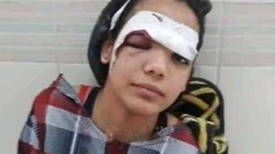 بعد إجراء جراحة لها.. آخر تطورات الحالة الصحية لفتاة الساطور بمطروح |صور