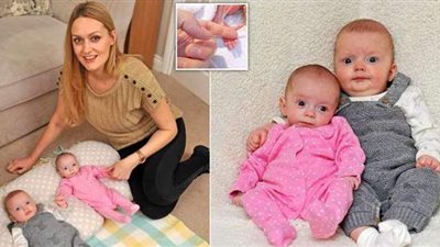 امرأة تضع طفلين «توأما» يكبر أحدهما الآخر بـ 3 أسابيع