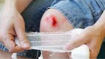 تفسير رؤية الجرح بالسكين في المنام