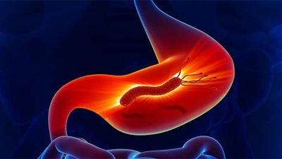 10 نصائح تساعد فى علاج جرثومة المعدة