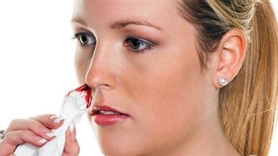 كيف تتعاملين مع إصابة أنف طفلك بالنزيف بسبب حر الصيف