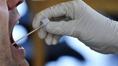 دراسة: تشخيص الإصابة بالسرطان أصبح أكثر شيوعا من الزواج والإنجاب