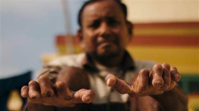 مرض الجذام | تعرف على الأسباب والمضاعفات والعلاج