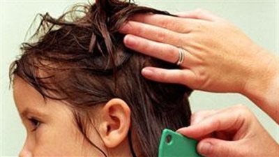 5 وسائل لعلاج الأطفال من عدوى حشرات الشعر