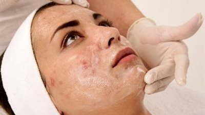 ماسك «المكونات الخمسة» لعلاج البشرة من أثار المصيف