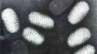 إصابة فتى أمريكي ببكتيريا نادرة تأكل خلايا المخ