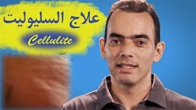 بالفيديو.. أسباب ظهور السيليوليت وأفضل طرق التخلص منه
