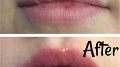 على الطريقة الهندية.. 5 طرق لتقشير الشفاه وتنعيمها