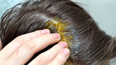 هاني الناظر يكشف وصفة سحرية للقضاء على تساقط الشعر