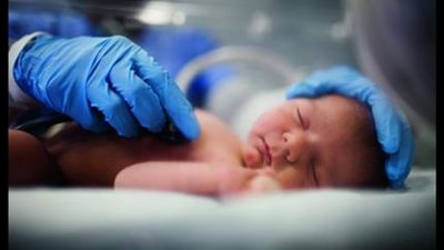 إعطاء الأطفال المبتسرين جرعات من الكافيين يحسن من وظائف الرئة