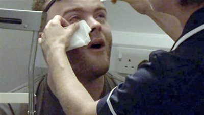 بالصور.. شاهد ماذا حدث لرجل ترك العدسات اللاصقة في عينيه أثناء نومه