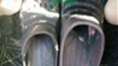 شاهد.. ماذا حدث لـ «كروكس Adidas» تركه صاحبه في الشمس