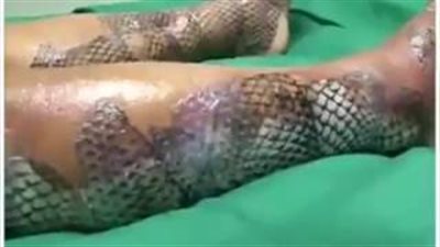 «سمك البلطي» مصدر مواد التجميل وعلاج الحروق الجديد.. «تقرير»