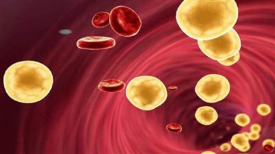 6 مشروبات تخفض الكوليسترول فى الدم