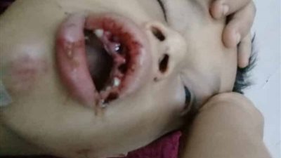 شاب يعتدي على طفل بوحشية بسبب مباراة كرة قدم (صور)