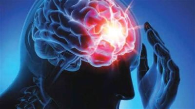 5 طرق لعلاج مرض الصرع وإرشادات وقت حدوث النوبة