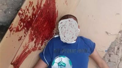 اعتداء مجهولين على عامل نظافة بطريقة وحشية بالمدينة المنورة