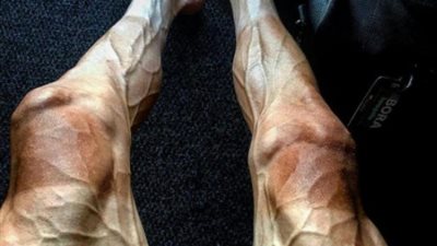 دراج ينشر صورة لساقيه تثير جنون الإنترنت