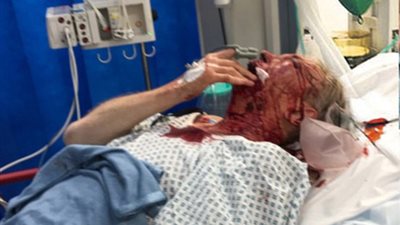 تعرض دبلوماسي بريطاني لاعتداء بالشارع ونقله إلى أحد المستشفيات