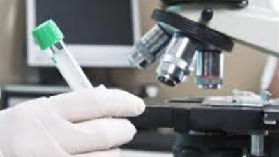 باحثة تتوصل إلى مستخلص من عشبة مضادة للالتهابات ومسكن للألم