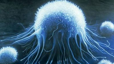 تطوير تقنية تدفع الخلايا السرطانية إلى «الانتحار»