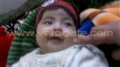 بالصور.. إهمال الأطباء يغتال براءة طفلة بالمنوفية.. تشخيص خاطئ يتسبب في إصابة 