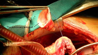 تسجيل تقنية استبدال الصمام الثلاثي في المجلات الدولية باسم مصر