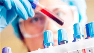 المعامل المركزية بوزارة الصحة | 7 شروط  لضمان سلامة عينات البول والدم قبل التحليل