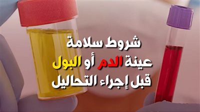 شروط سلامة عينة الدم أو البول قبل إجراء التحاليل | فيديوجراف