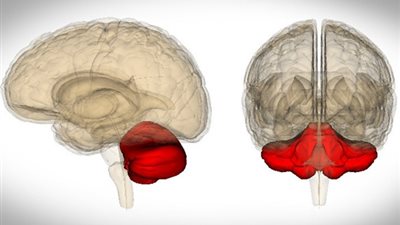 مفاجأة.. امرأة تعيش بدون مخيخ