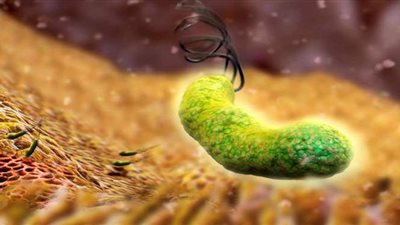 أعراض الميكروب الحلزوني وطرق العلاج